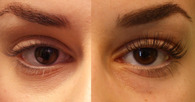 Le ré-haussement des cils : une opération délicate !